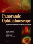 Panoramic Ophthalmosopy: Optomap Images And Interpretation (Hardcover)